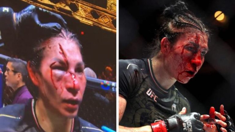 UFC 306: Irene Aldana Faces Severe Cut in Sphere Defeat