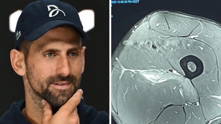 Djokovic Claps Back at ‘Injury Experts’ with Scans in Social Media Post