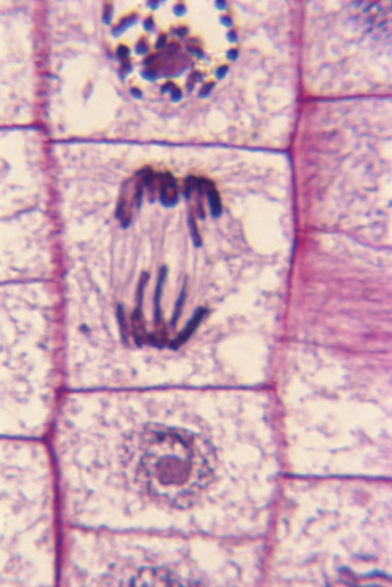 Identifying Stages of Mitosis in Cells Under a Microscope