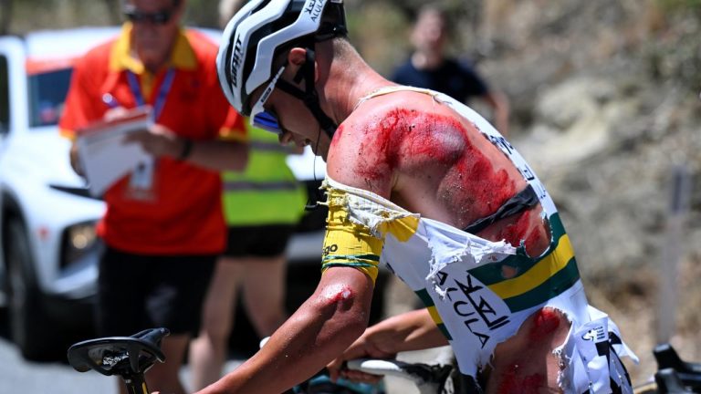 Luke Plapp Withdraws from Tour Down Under Due to Terrible Crash